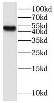 MKNK2 Rabbit Polyclonal Antibody