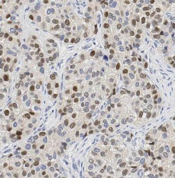 DUSP4 Antibody