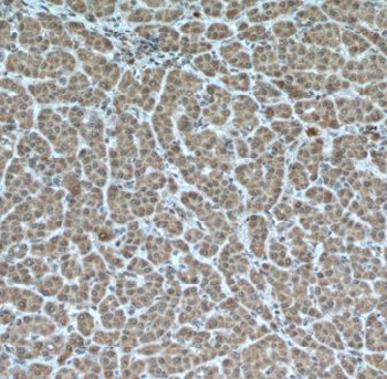 MKS1 Antibody