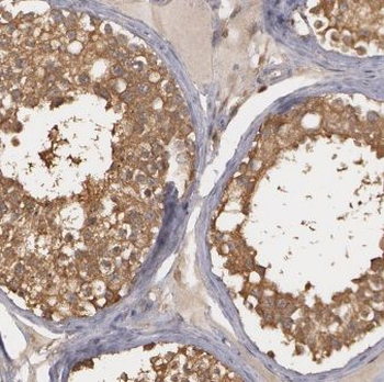 CENPU Antibody