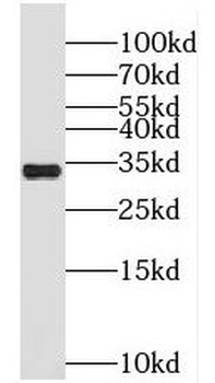 MLX Rabbit Polyclonal Antibody