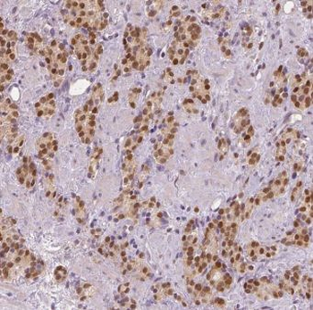 MLX Rabbit Polyclonal Antibody