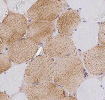 MLXIP Antibody
