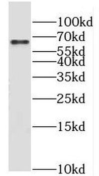 MLXIPL Antibody