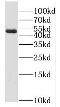 MLYCD Antibody