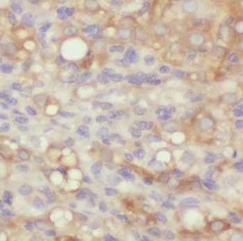 MMAB Antibody