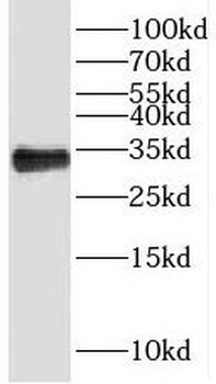 MMADHC Rabbit Polyclonal Antibody