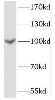 MME Rabbit Polyclonal Antibody