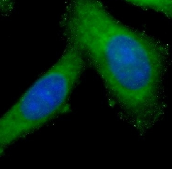 MMP12 Antibody