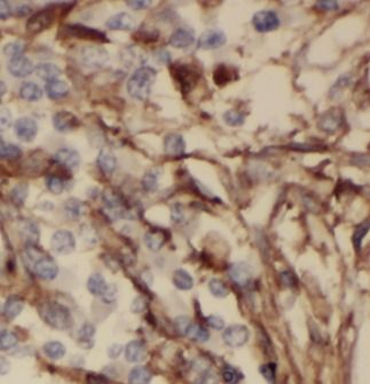 MMP12 Antibody