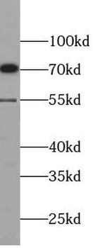MMP13 Rabbit Polyclonal Antibody