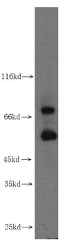 MMP2 Rabbit Polyclonal Antibody