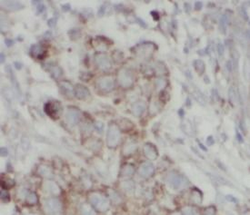MMP2 Rabbit Polyclonal Antibody