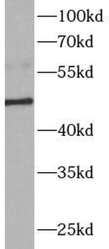 MMP3 Rabbit Polyclonal Antibody