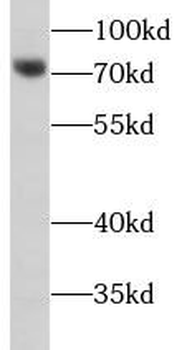 MMP8 Rabbit Polyclonal Antibody