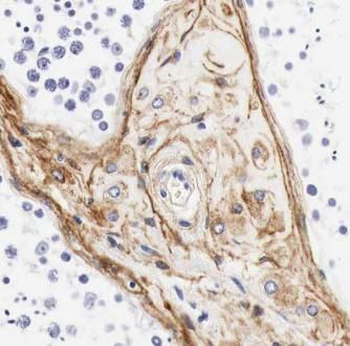 MMP8 Rabbit Polyclonal Antibody