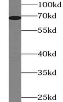 MMP9 Rabbit Polyclonal Antibody