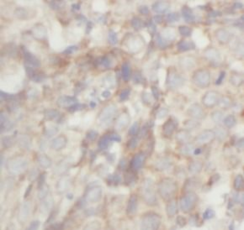 MMP9 Rabbit Polyclonal Antibody