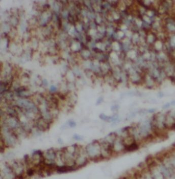 UBE2V2 Antibody