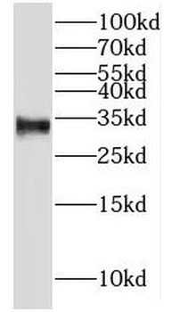 MND1 Antibody