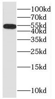 MKNK1 Rabbit Polyclonal Antibody