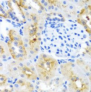 MOK Rabbit Polyclonal Antibody