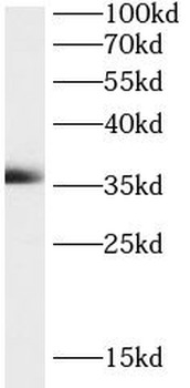 MTARC2 Rabbit Polyclonal Antibody