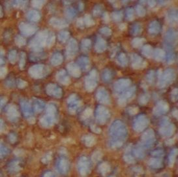 MTARC2 Rabbit Polyclonal Antibody