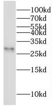 MOSPD3 Rabbit Polyclonal Antibody
