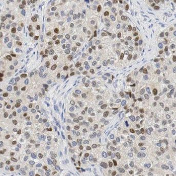 MPHOSPH6 Antibody