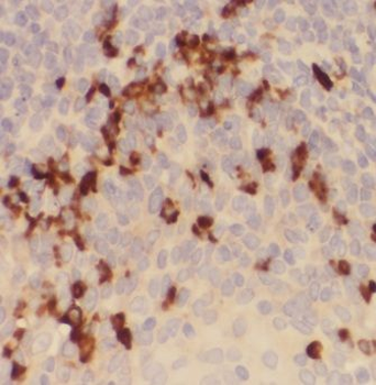 MPO Mouse Monoclonal Antibody