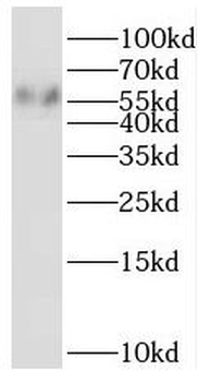 PALS2 Rabbit Polyclonal Antibody