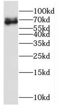 MPP7 Antibody