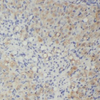 MPP7 Antibody
