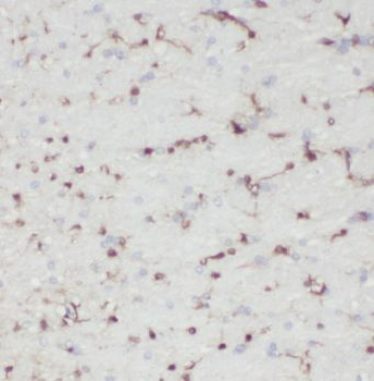 MPPED2 Antibody