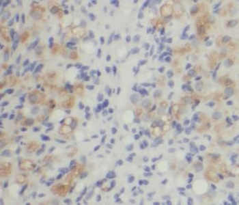 MPRIP Antibody