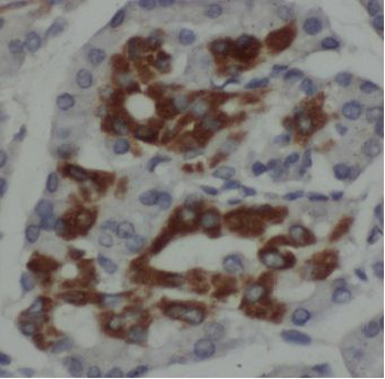 MPV17 Antibody