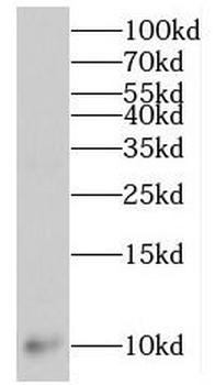 MPV17L Antibody
