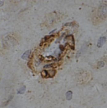 MRAP2 Antibody