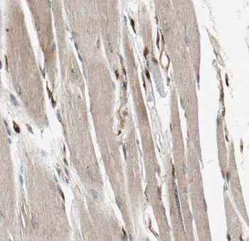 MRAS Antibody