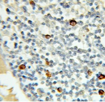 MRE11 Antibody