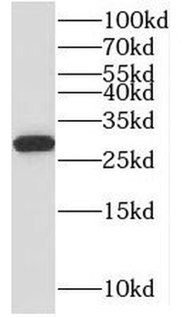 MRPL10 Antibody