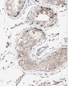 MRPL10 Antibody