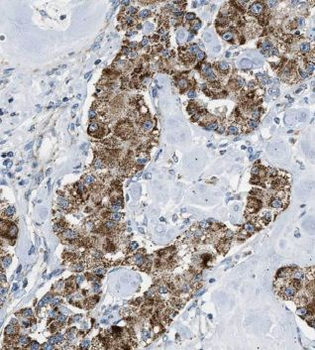 MRPL13 Antibody