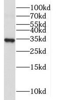 MRPL19 Antibody
