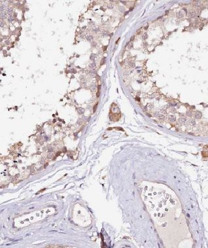 MRPL19 Antibody