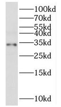MRPL2 Antibody