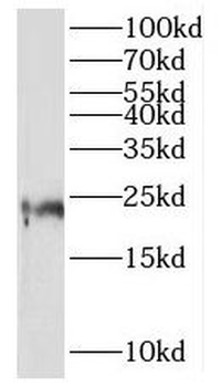 MRPL21 Antibody