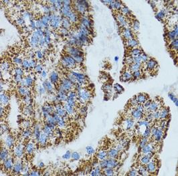 MRPL28 Antibody