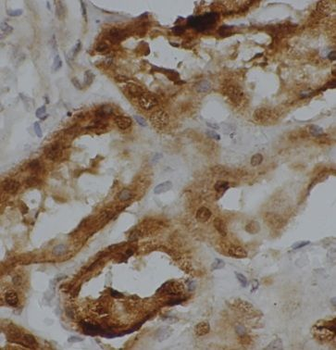 MRPL33 Rabbit Polyclonal Antibody